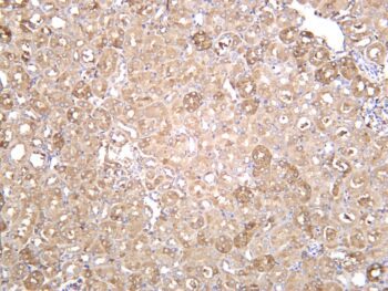 Ferritin Heavy Chain Rabbit Monoclonal Antibody - Image 2