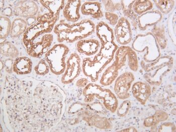 Src Rabbit Monoclonal Antibody - Image 2